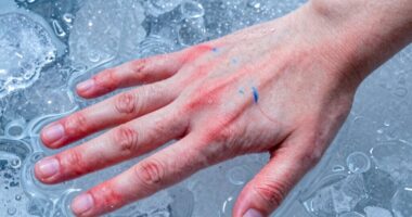 blood vessel constriction response