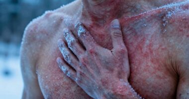 cold reduces perceived soreness