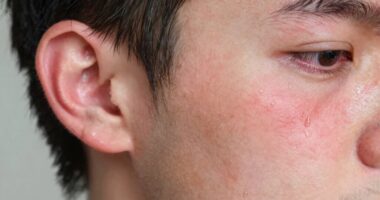 water quality causing irritation