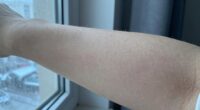body s response to cold
