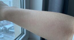 body s response to cold