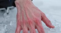 cold increases blood flow