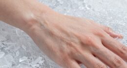cold sensation adaptation process