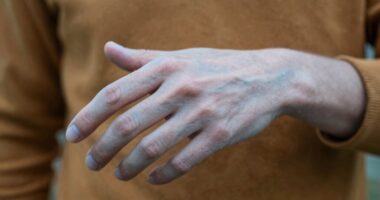 extremities cool faster