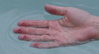 sensitive skin temperature differences