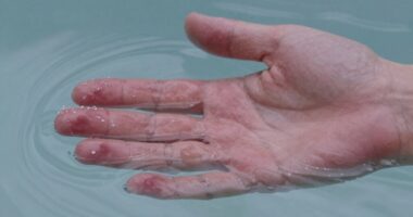 sensitive skin temperature differences