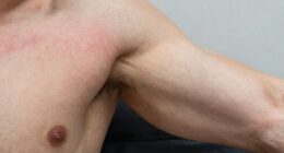 soreness differs from recovery